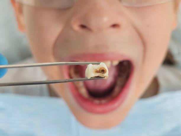 Best Emergency Denture Repair in Chester, VA